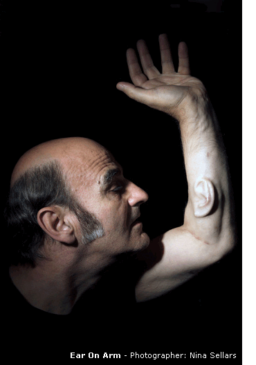 stelarc_earportrait318